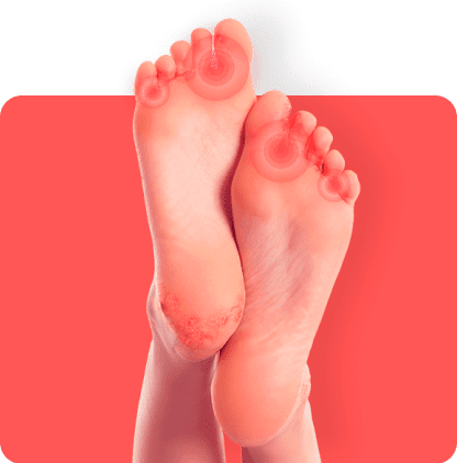 ПрImeр запускания болезни